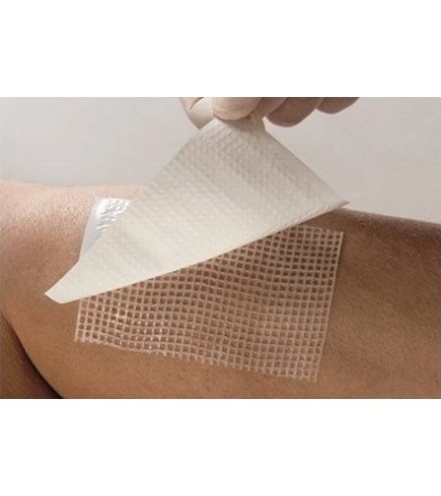 Парапран -Стимулююча пов'язка на рану з химотрипсином 7,5х10 см, прод поштучно №10в уп