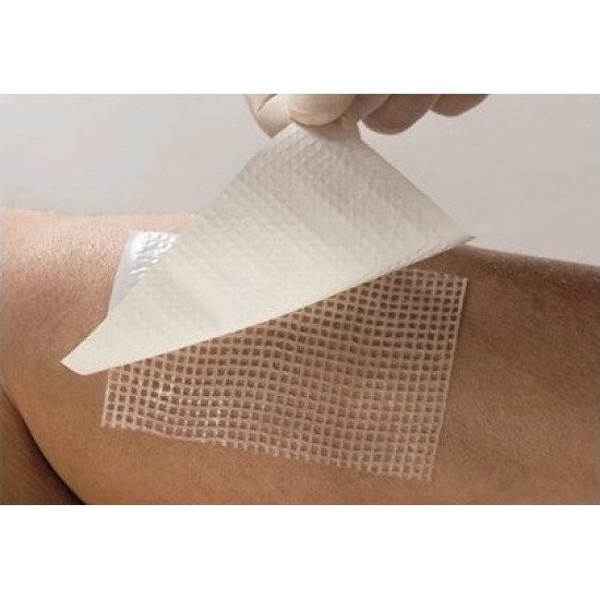 Парапран -Стимулююча пов'язка на рану з химотрипсином 7,5х10 см, прод поштучно №10в уп