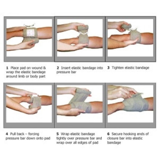 Пакет кровозупиняючий стер. 